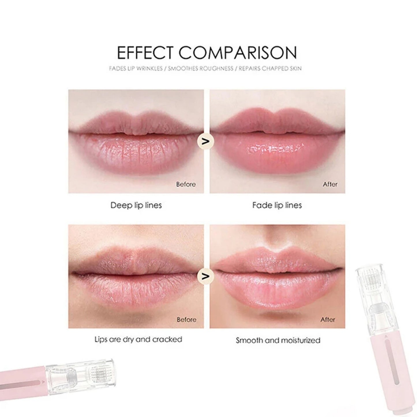 3 In 1 Lip Care Roller